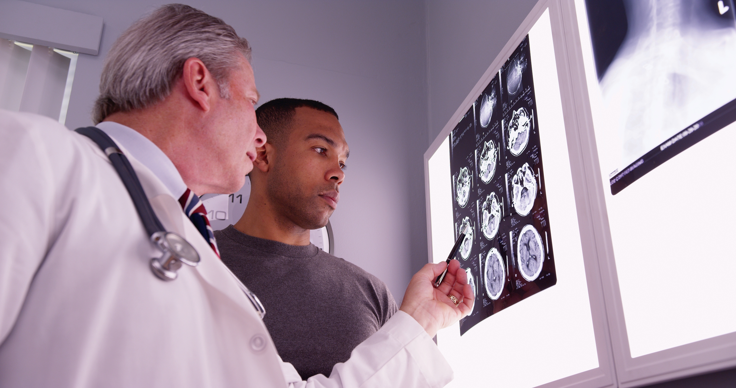 doctor and patient looking at brain scan